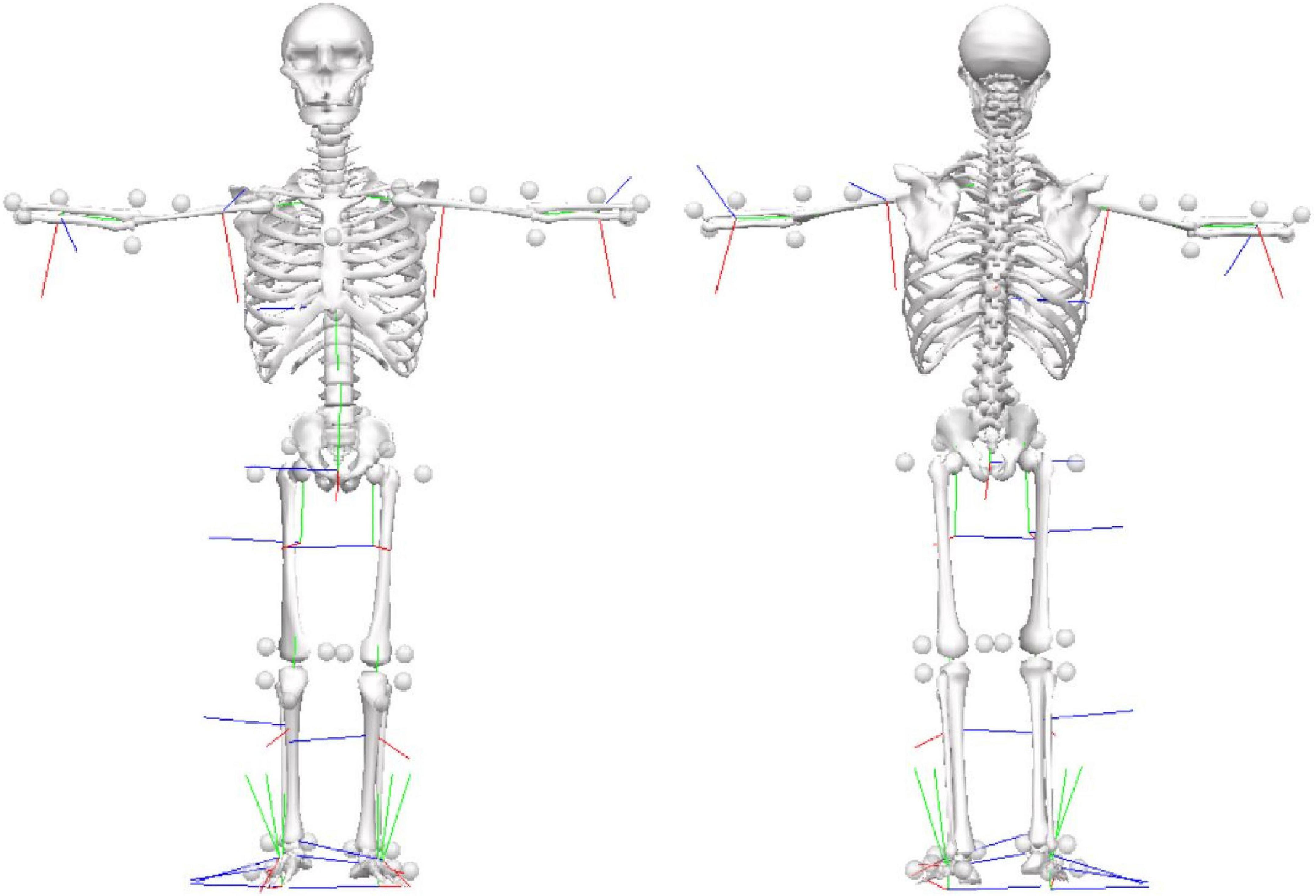 A public data set of walking full-body kinematics and kinetics in individuals with Parkinson’s disease